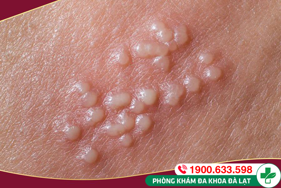 Hình ảnh minh họa